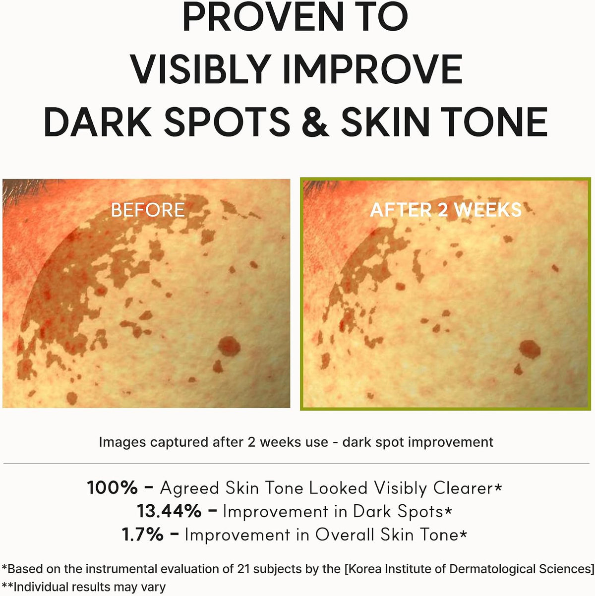 Arencia Vitamin C booster shot