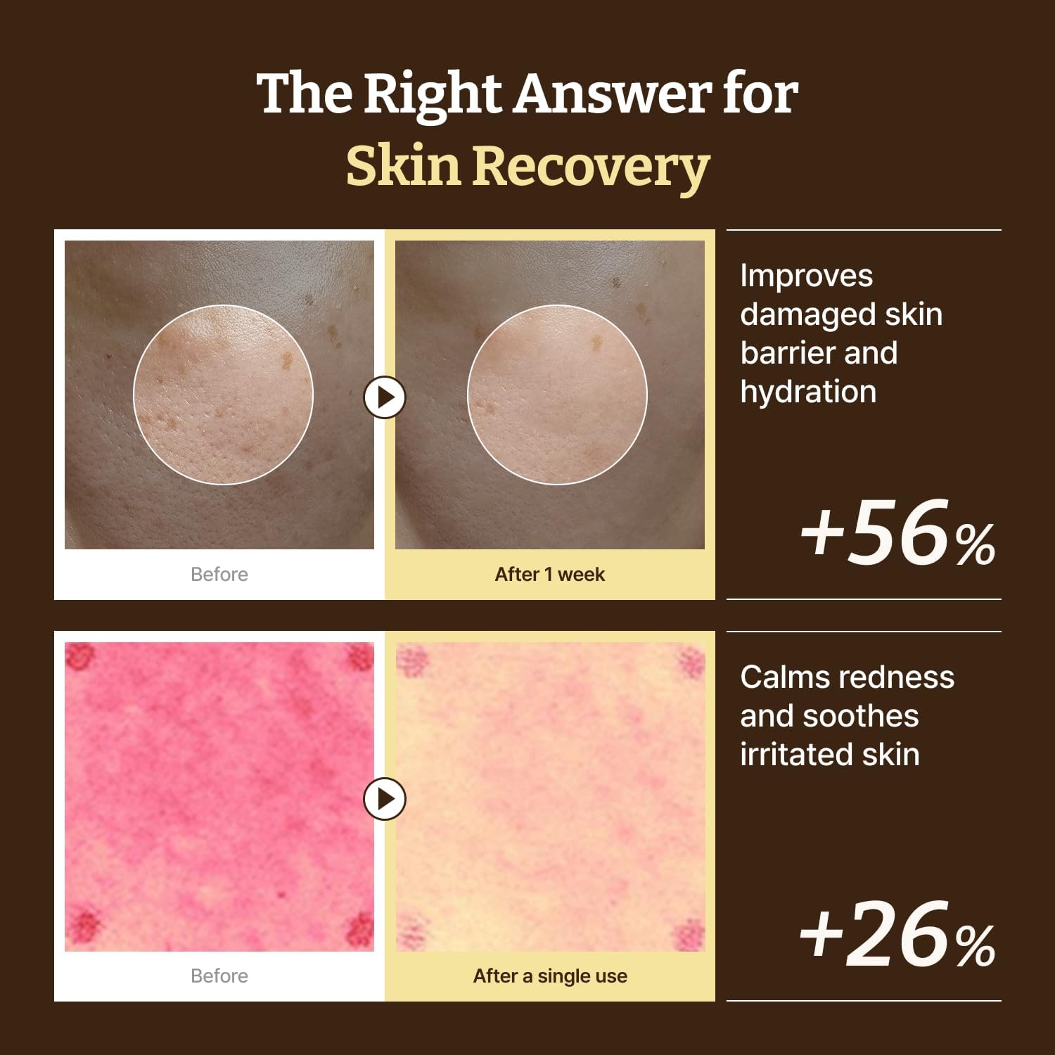 Dr. Reju-All Advanced PDRN Rejuvenating Cream