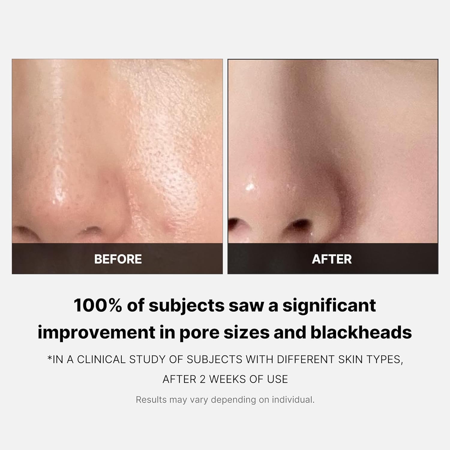 Medicube Zero Pore Pad 2.0