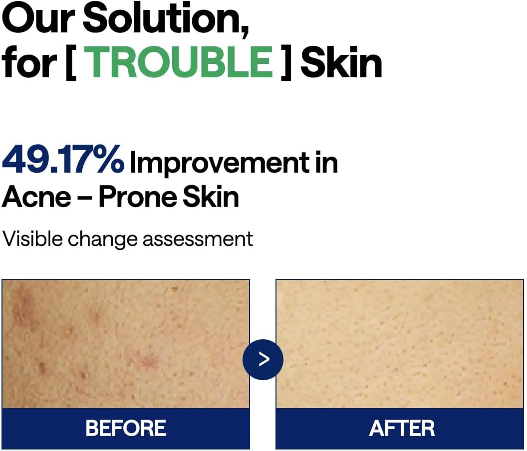 Mediheal Tea Tree Trouble Pad