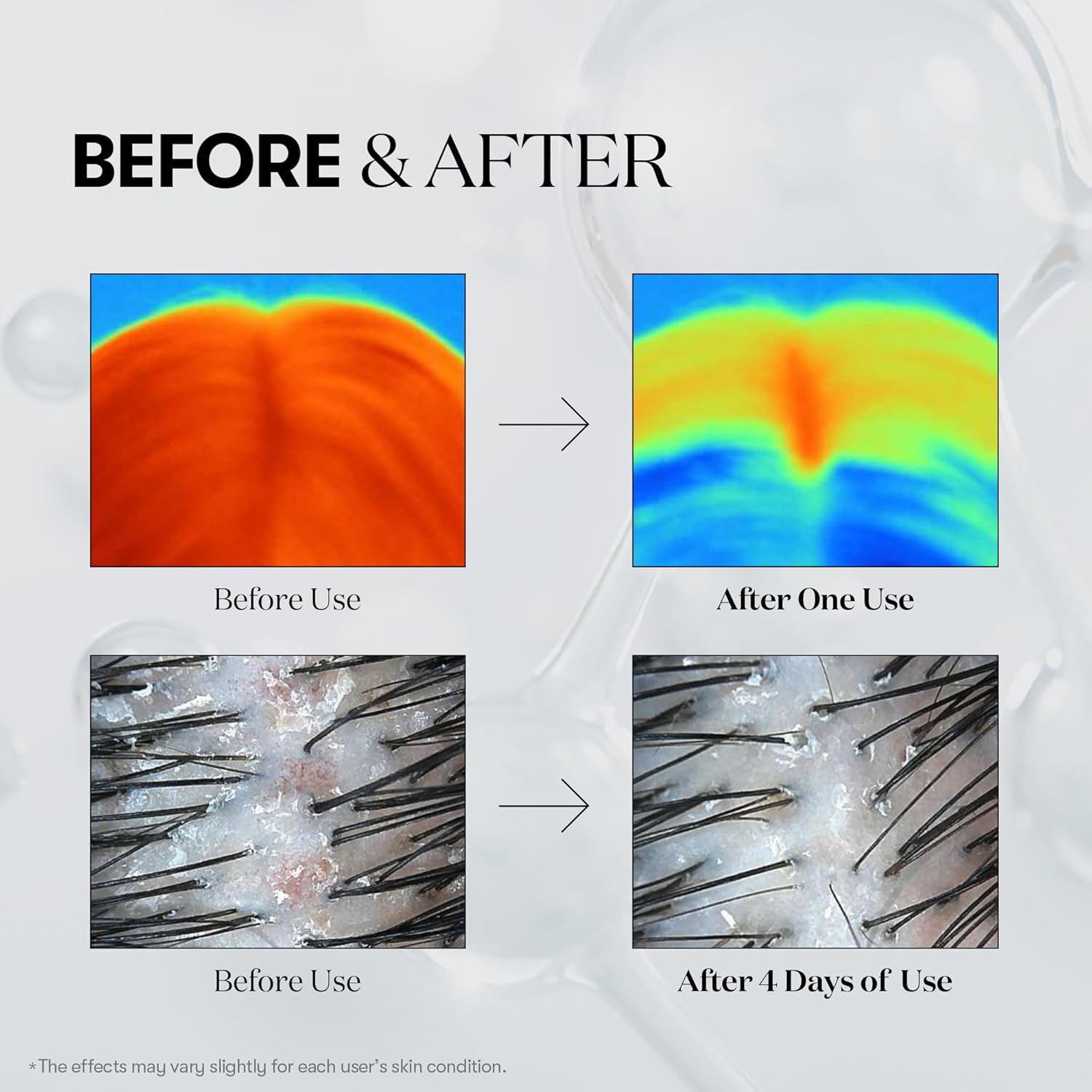 VT PDRN Reedle Shot Hair Ampoule 100dL